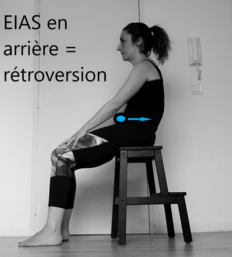 femme assise faisant une retroversion du bassin, définie par le recul de l'EIAS. Bascule postérieure.
