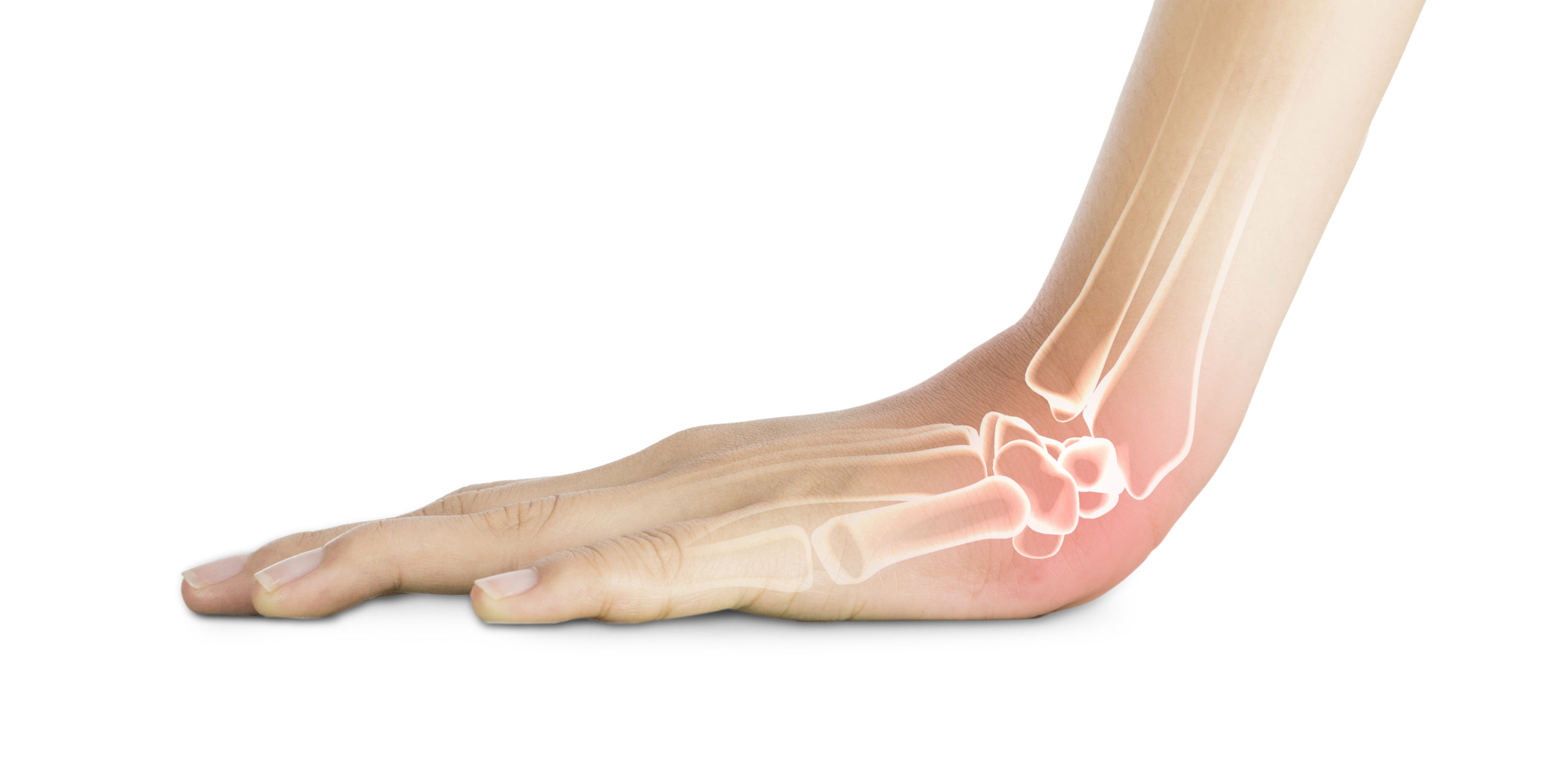 L'arthrose du poignet: symptômes, traitements et ostéopathie - Ostéo Do