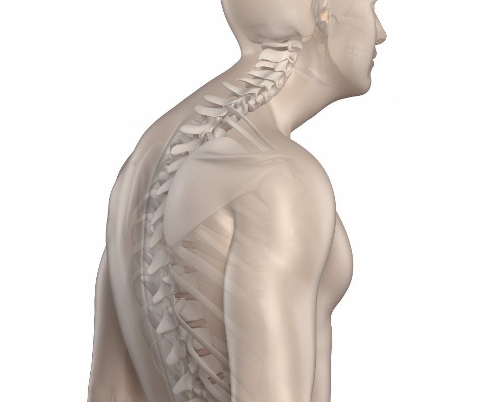 La cyphose dorsale est une flexion exagérée du haut du dos, un dos rond ou une bosse.